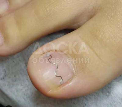 Услуги Подолога