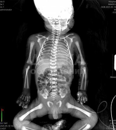 "Цифровой рентген на дому".